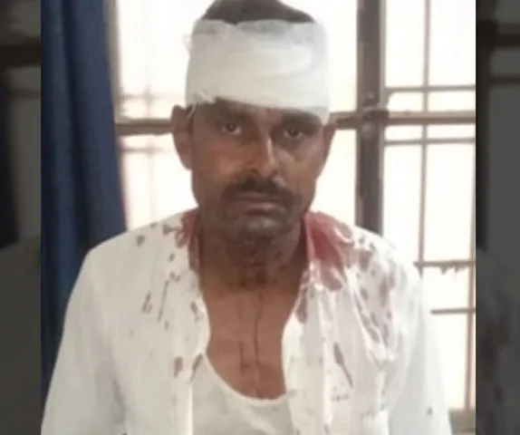 निगोही-में-बंदरों-के-हमले-से-घायल-अजय-पाल